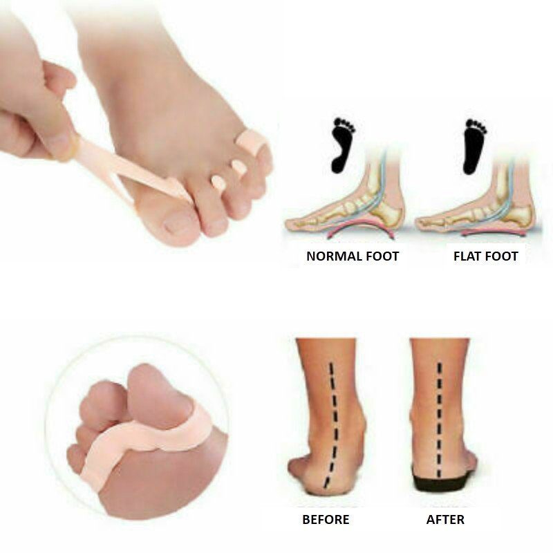 Orthopedic Bunion, Toe And Posture Corrector - TrendBaron.com